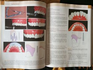 PROSTHODONTICS - V. RANGARAJAN