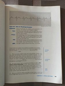 Basic Arrhythmias, Third Edition