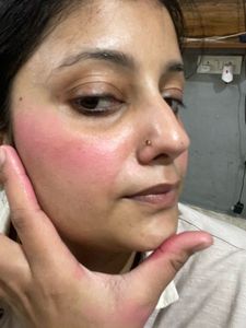 Lip And Cheeks Tint
