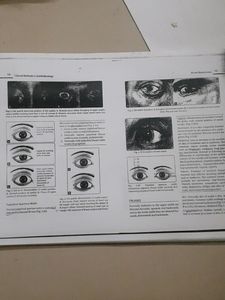 Ophthalmology Clinical Manual For Mbbs
