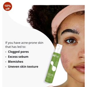 Lightweight Moisturiser for Oily, Acne Prone Skin
