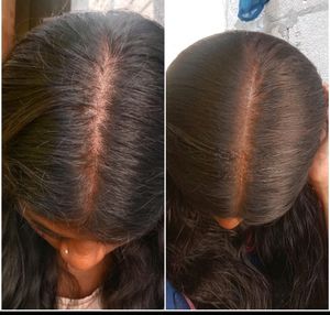 Homemade Secret Herbal Hair growth Oil