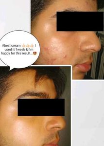 Fairness Cream