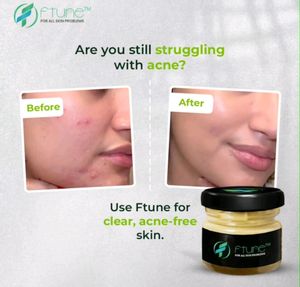 Ftune Skin Whitening Cream