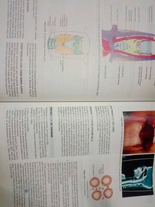 ENT-DHINGRA Medical Textbook