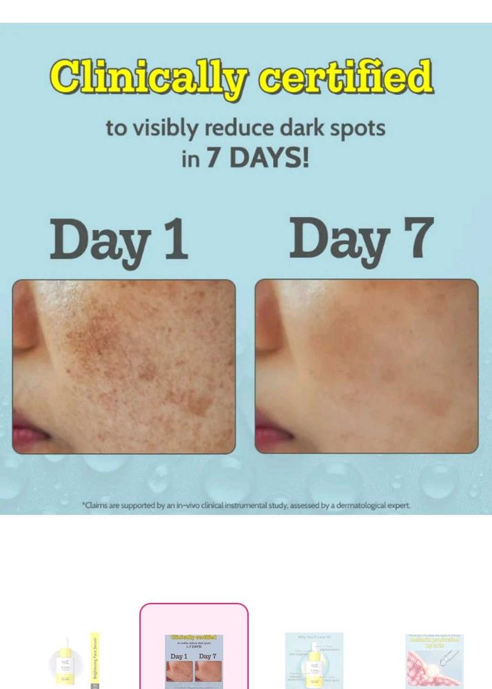 Dark Spot Reduction Cream