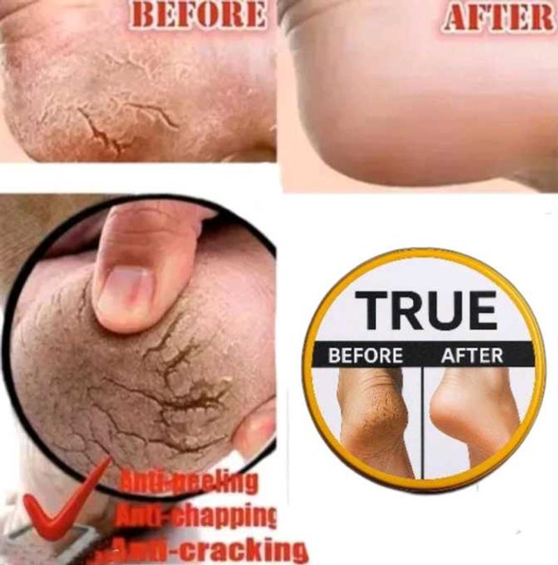 Skin Healer Cream