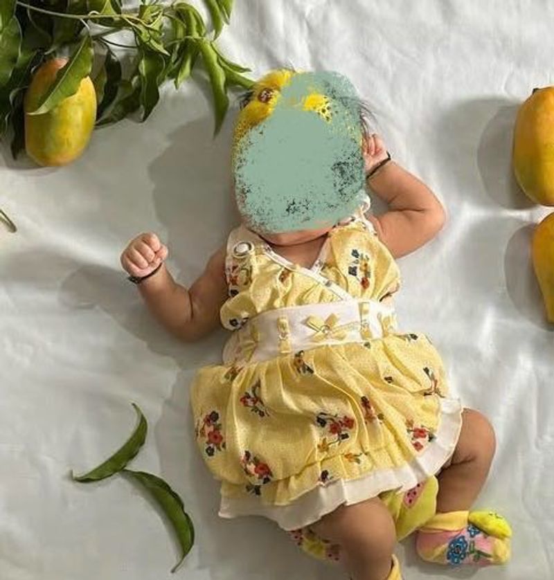 Yellow Color Baby Girl Frok