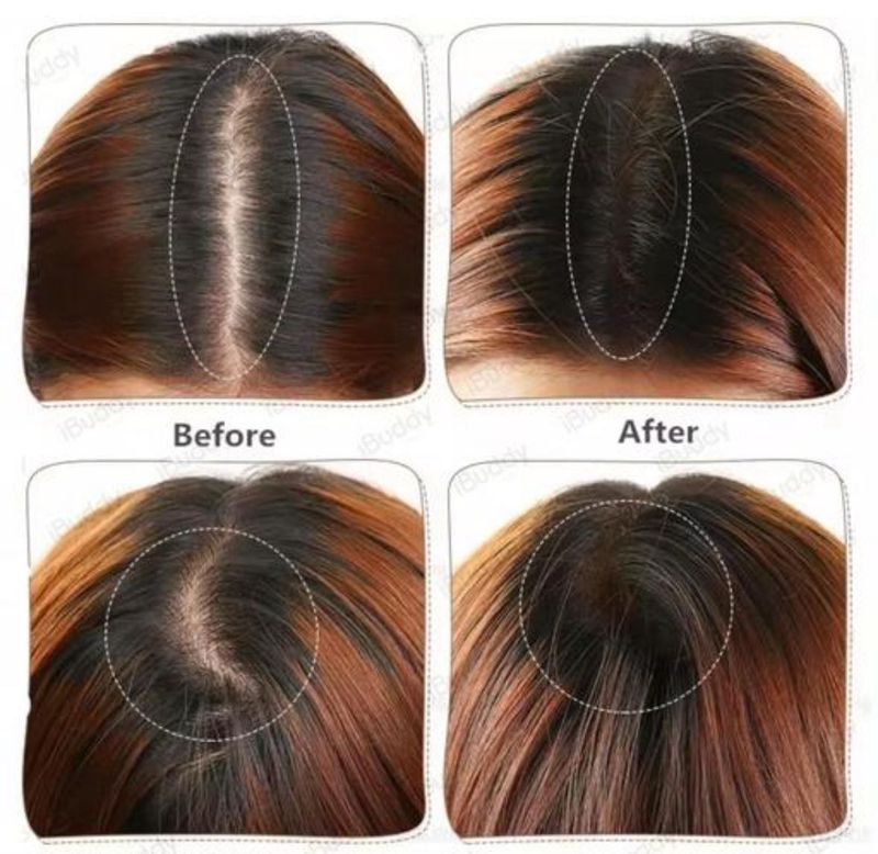 Hair Loss Concealer