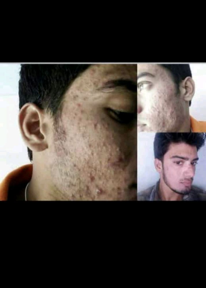 Hair And Skin All Problem Solution