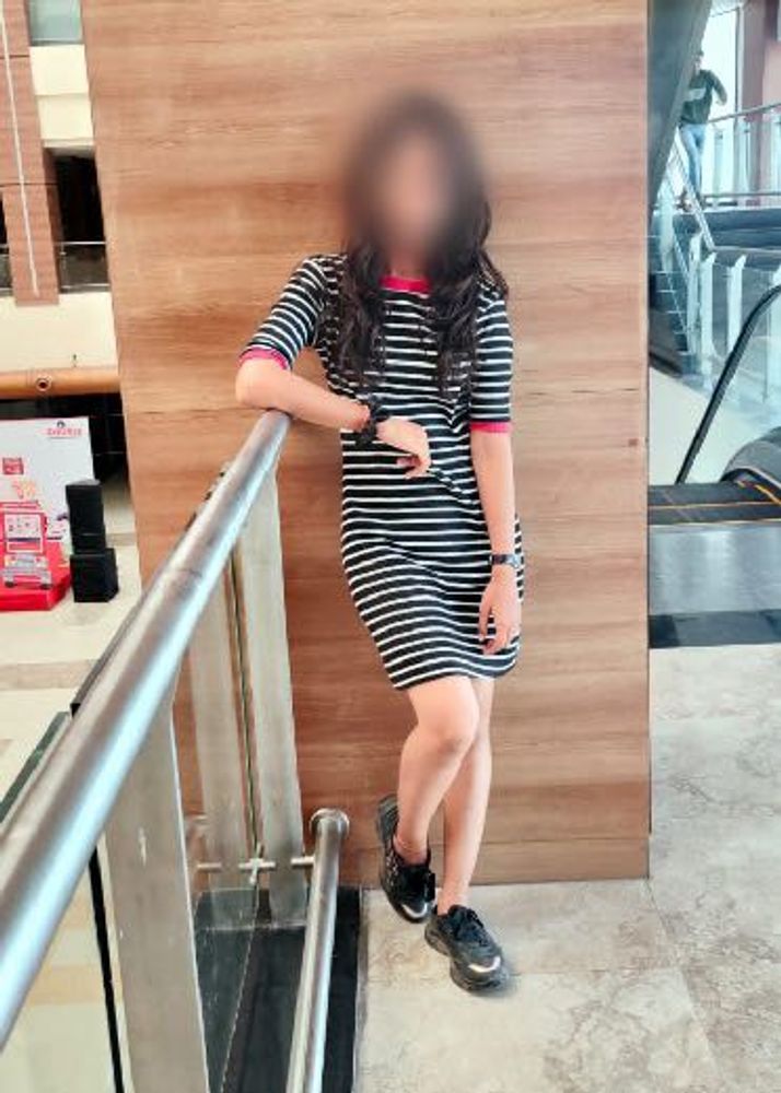 Striped Casual Dress