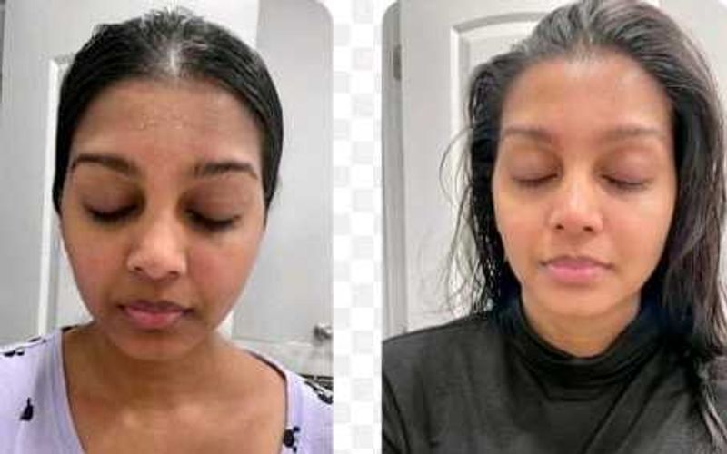 Skin Care Transformation Cream (Dermatologist)