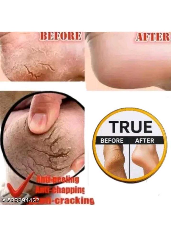 Crack Healing Balm