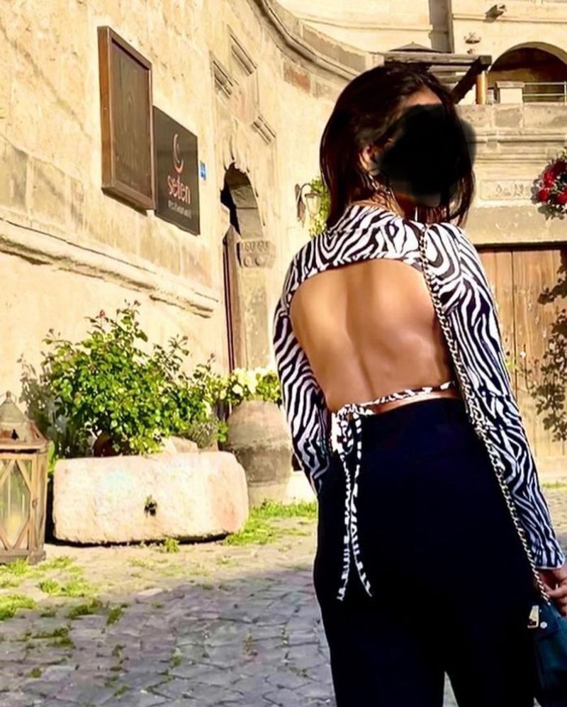 Backless Hot Zebra Top