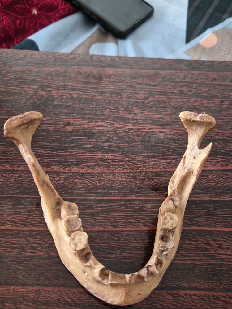 skull,sclap ,madable and vertebre