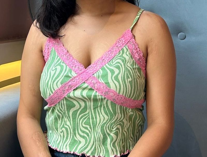 Green Zebra Lace Trim Cami