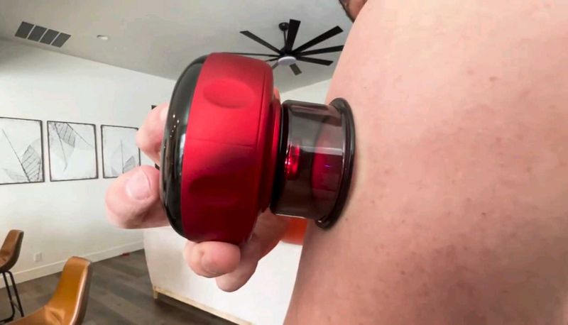 Electronic Cupping Therapy Machine