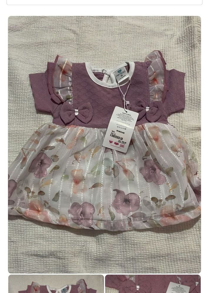 Baby Dresses Combo