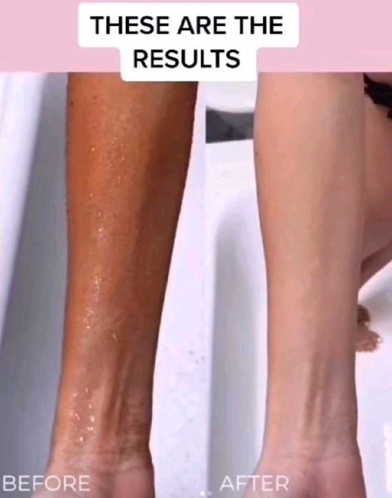 No Side Effect Whitening Cream 20g