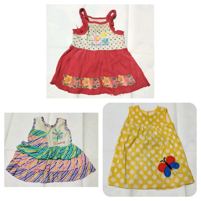 Cute Baby Girl Dress Bundle