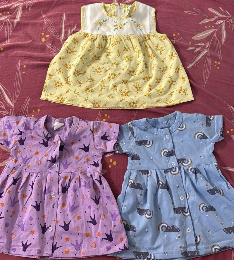 Cute Baby Dresses (Set of 3)