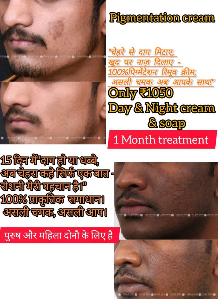 Pigmentation Cream Kit